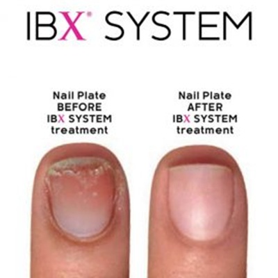 ibx nail repair in Holywood, Belfast