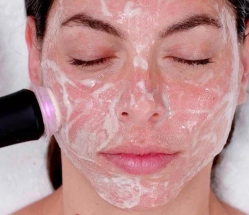 Geneo Super Facials at Karma Salon in Holywood, Belfast