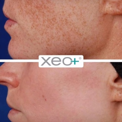 https://festive-raman.34-246-88-53.plesk.page/laser-genesis-facials/