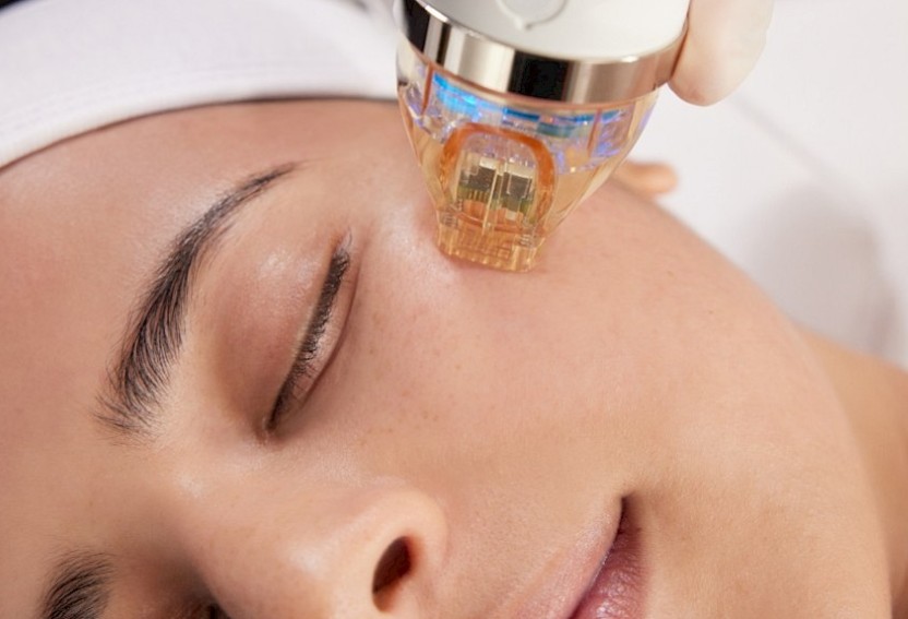 Radiofrequency Treatments at Karma Salon Holywood Radiofrequency Treatments at Karma Salon Holywood