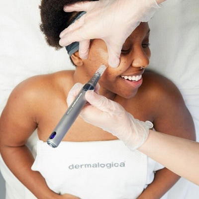 dermalogica luminFusion treatments in holywood, Belfast